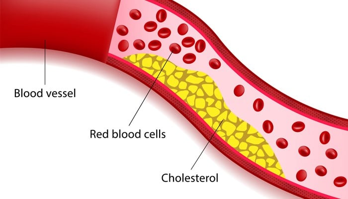 7 Day Meal Plan to Lower Cholesterol 7 Day Meal Plan to Lower Cholesterol